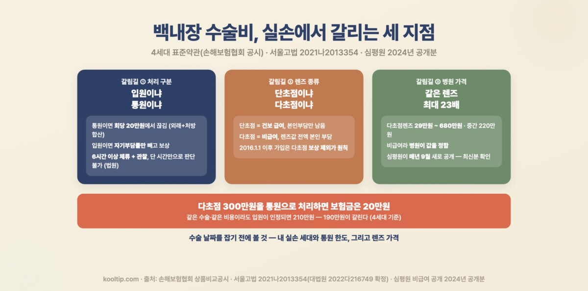 백내장 수술비 실손 갈림길 인포그래픽 — 통원 회당 20만원 한도, 2016년 이후 가입은 다초점 보상 제외 원칙, 같은 렌즈 최대 23배 가격차